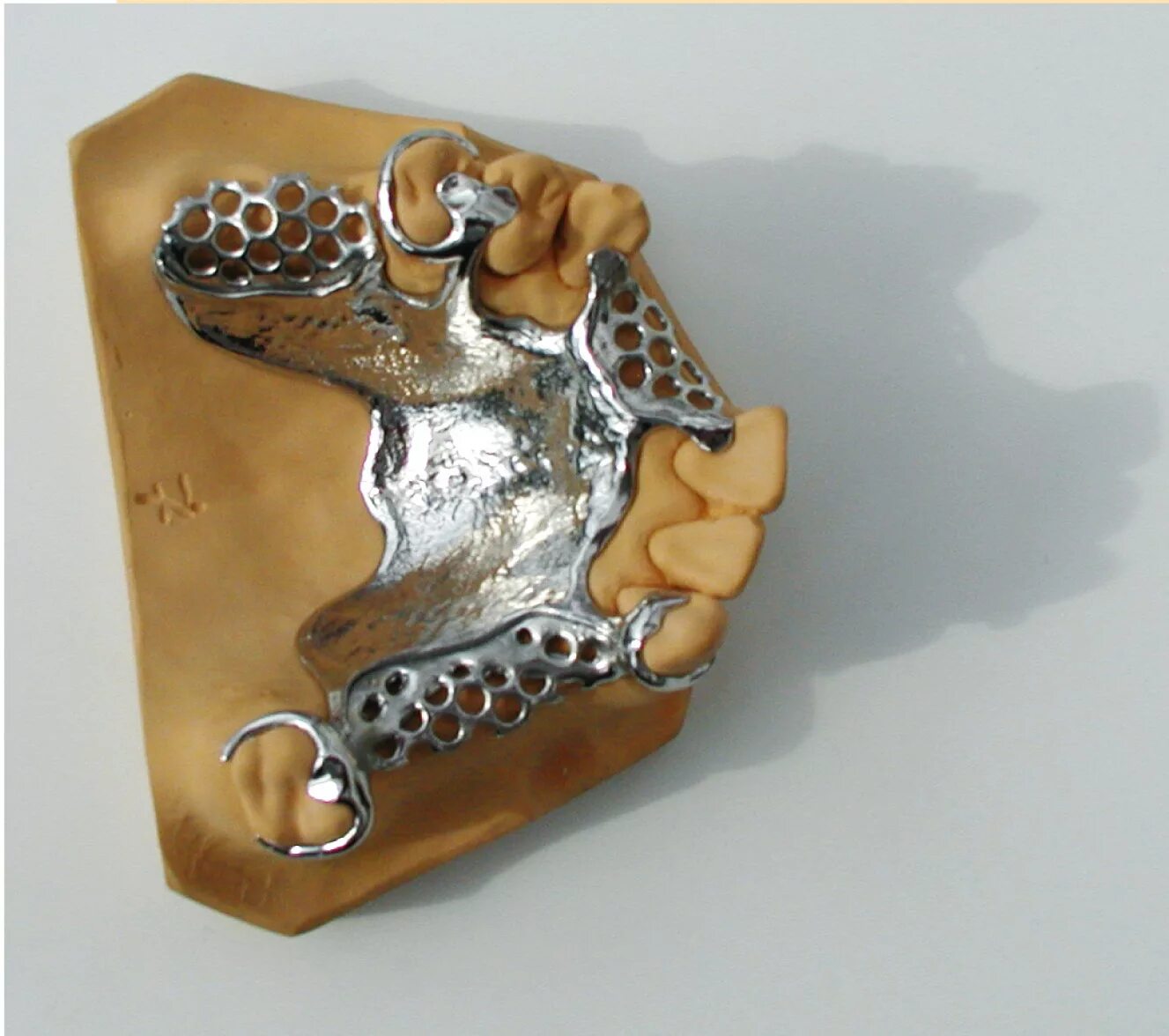 бюгельный протез на огнеупорной модели. литниковая система на бюгельных протезах. каркас бюгельного протеза.