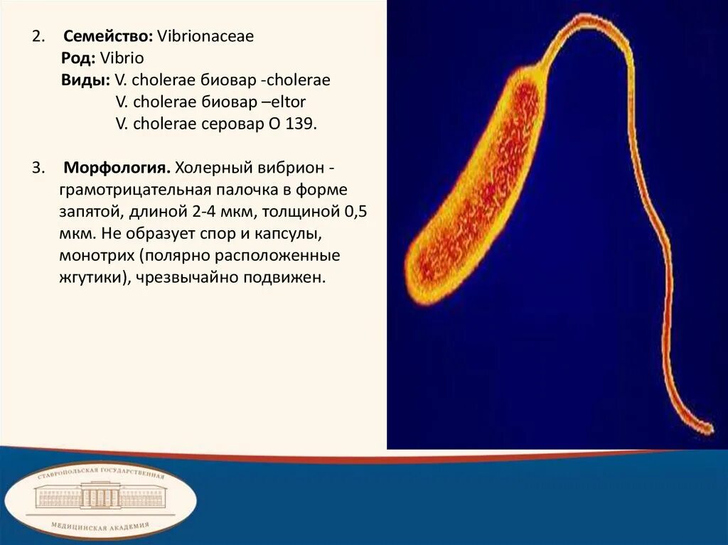 Известно что холерный вибрион вид подвижных. Холерный вибрион микробиология. Vibrio cholerae морфология. Холерный вибрион препарат.