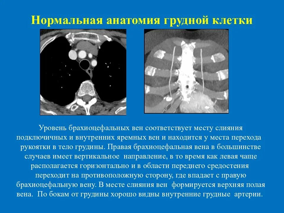 Перед кт грудной клетки можно кушать