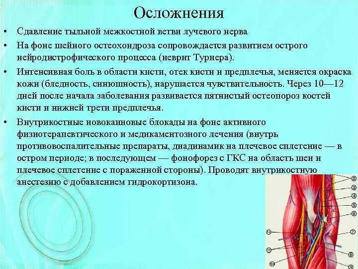 Нарушение чувствительности при поражении лучевого нерва. Неврит лучевого нерва осложнения. Посттравматическая невропатия лучевого нерва. Туннельный синдром локтевого сустава. Невропатия локтевого нерва лечебная физкультура.