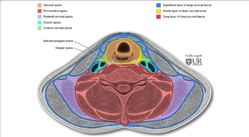 Cellular space. Четырехугольное пространство анатомия. Паравертебральное пространство анатомия. Метастазы в забрюшинное пространство анатомия. Позадиглоточное пространство анатомия.