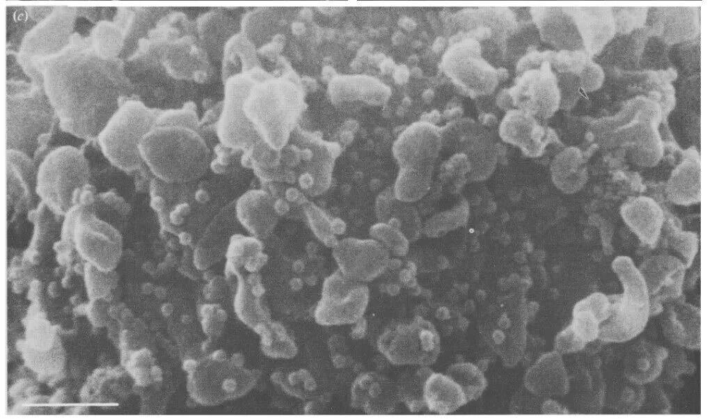 вирус вич под микроскопом. вирус вич под микроскопом. клетка вич под микроскопом. вирус гепатита с микроскопия. вич бактерия.