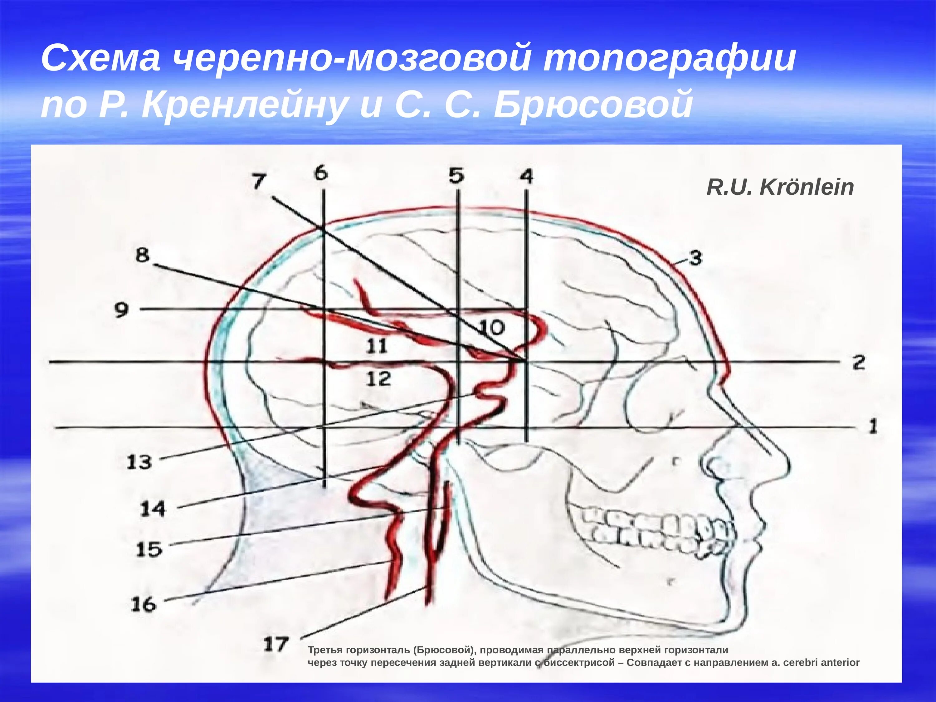 Схема черепно-мозговой топографии. Схема кренлейна-брюсовой сагиттальная линия. Схема черепно-мозговой топографии кренлейна-брюсовой. Проекцию средней менингеальной артерии по схеме кренлейна-брюсовой. Схема кренлейна-брюсовой.