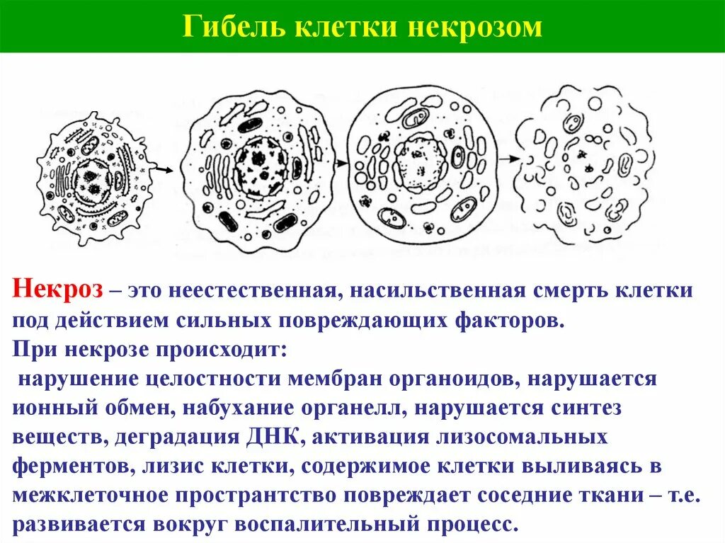 Микроскопические изменения в клетках. Схема гибели клеток при некрозе и апоптозе. Некроз клетки. Некроз схема. Некроз клетки схема.