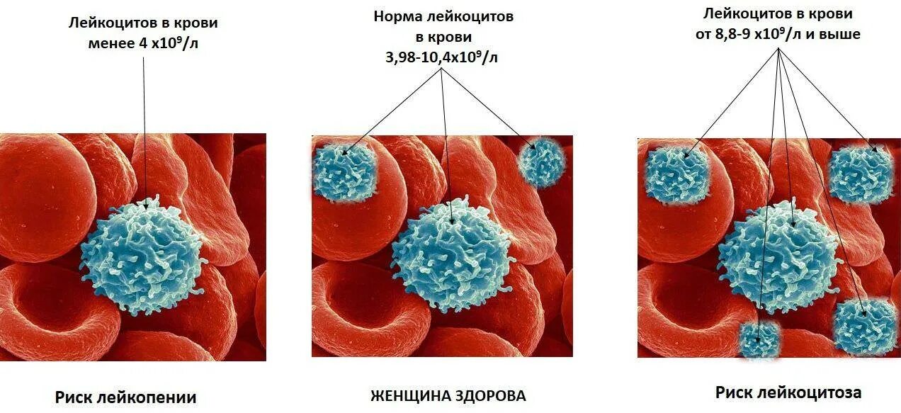 Увеличенное количество лейкоцитов в крови. Показатели лейкоцитов в крови норма. Лейкоциты периферической крови. Лейкоцитоз в крови показатели крови. Признаки лейкоцитоза