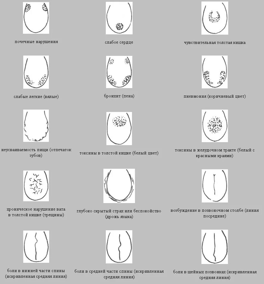 Язык признак какой болезни. Болезни по языку определить. Диагностика заболеваний по языку.