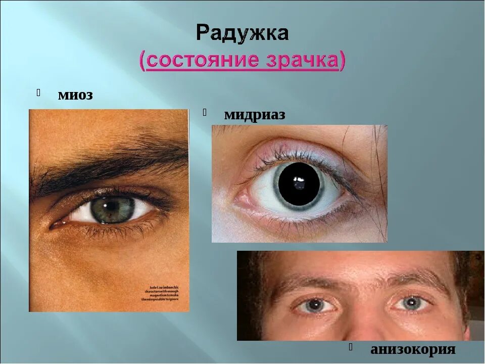 Изменение зрачка. Изменение зрачка