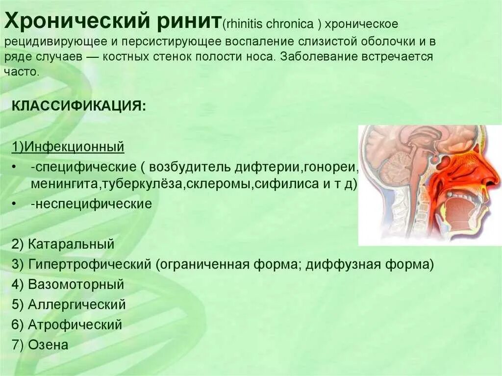 Хроническая простуда. Хронический ринит симптомы.