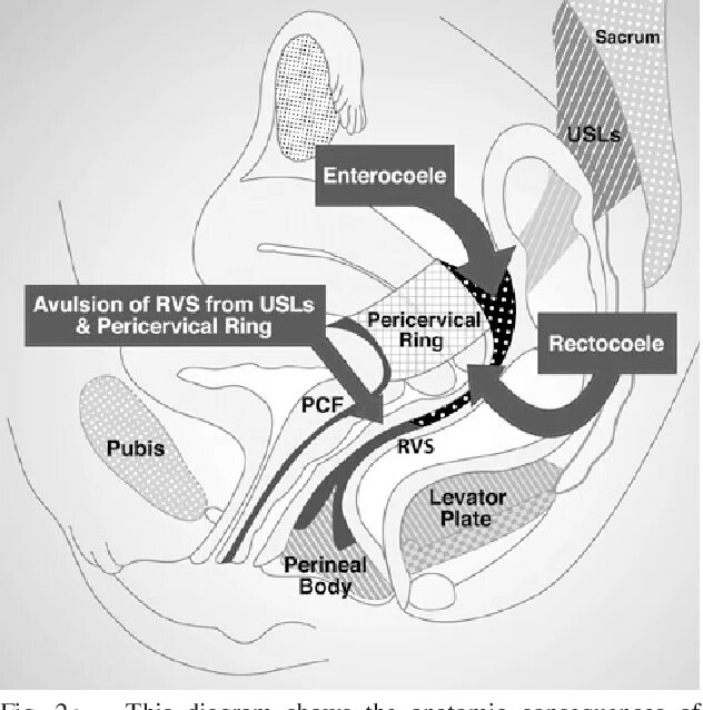 Мужские эрогенные зоны. Чувствительные точки во влагалище. Anterior Fornix erogenous Zone.. Эрогенные точки клитора. Зона AFE.