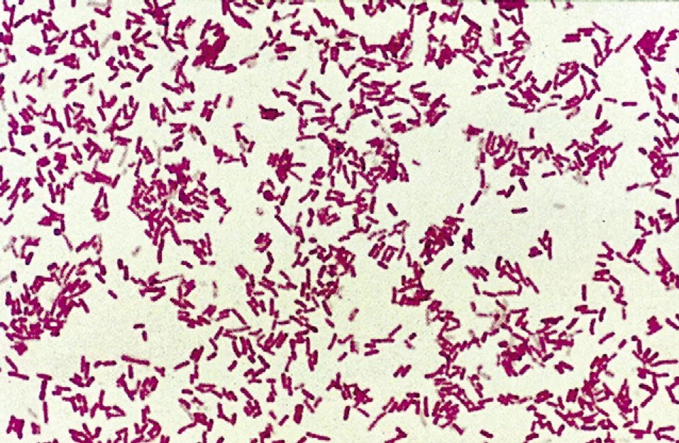 Clostridium spp. Клостридии ботулизма. Clostridium botulinum микроскопия. Клостридии микроскопия.