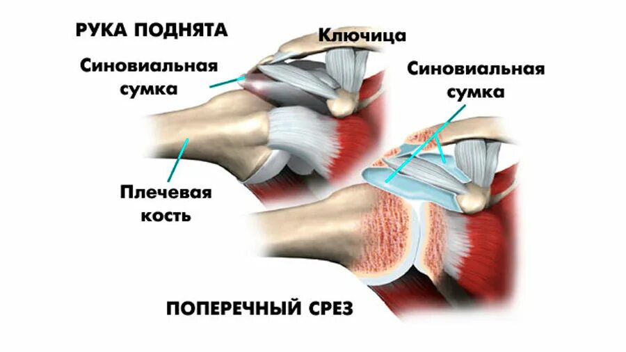 Сильная боль в области плечевого сустава. Ротаторная манжета плечевого сустава анатомия. Субакромиальное пространство плечевого сустава. Плечевой сустав левой руки.