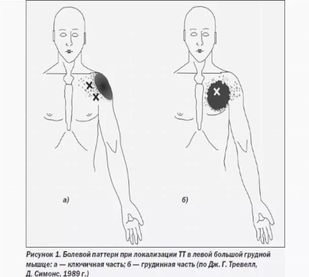 Боль в груди причины. Боли в грудной клетке. Болит сердце отдает в лопатку. Боль в спине. Болит сердце.
