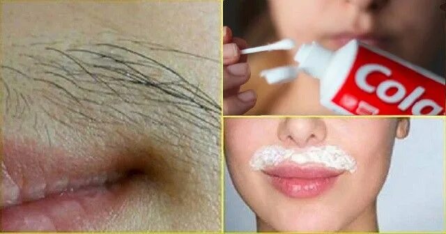 Депиляция лица. Нежелательные волосы на лице. Как убрать волосы над верхней. Как убрать волосы над верхней. Крем от усов для женщин.