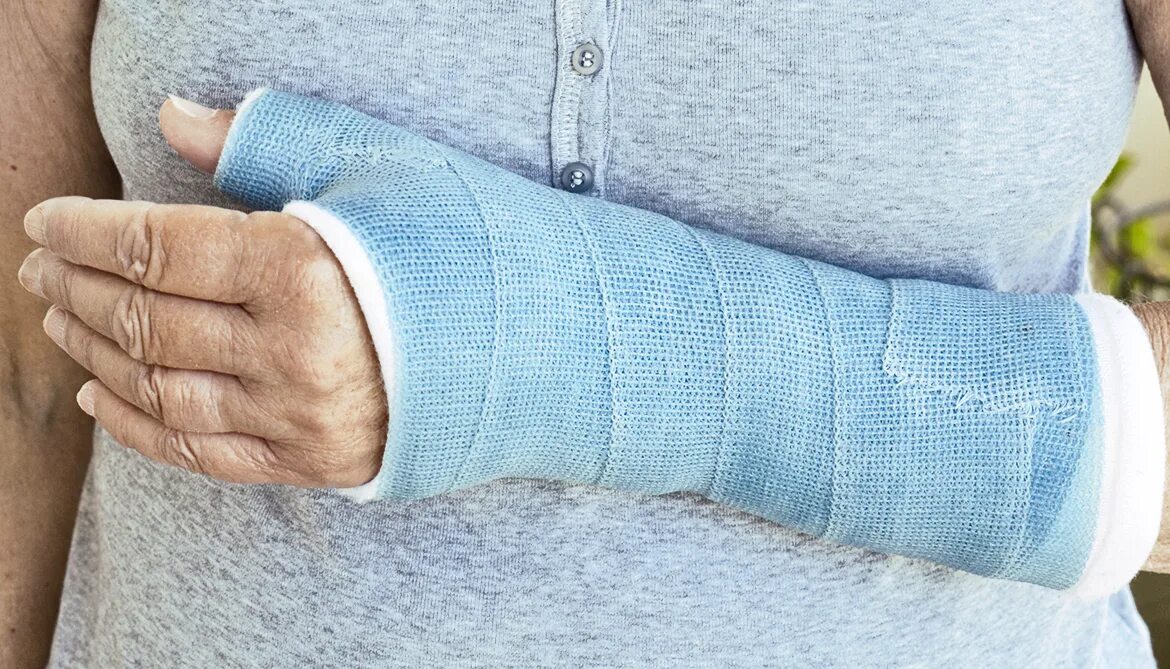 Можно ли париться после перелома. Можно греть перелом руки. Гипс при ппреломе зарчстья. Бинт повязка. Можно греть перелом руки.