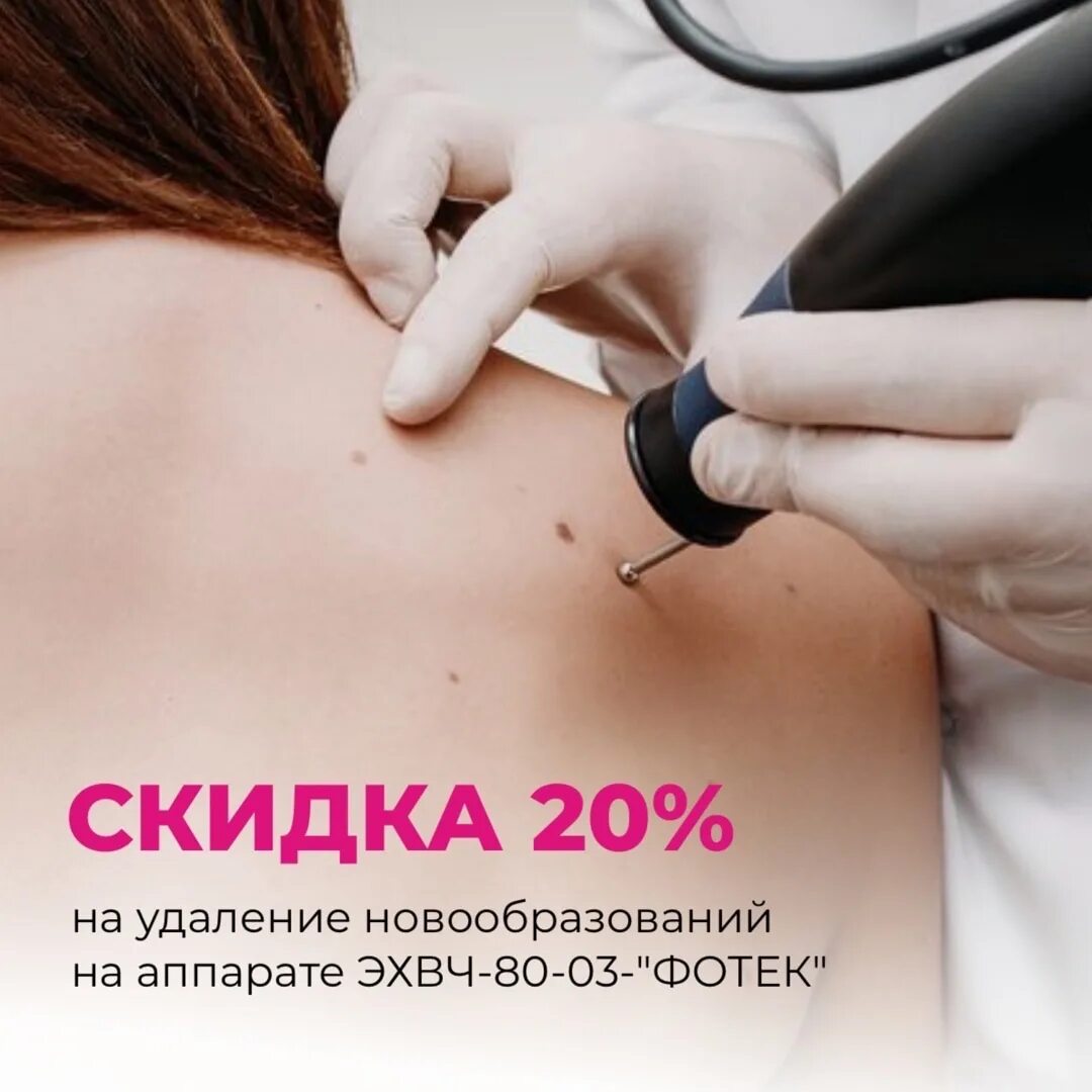 Родинка таманская ул. Родинка краснодар отзывы. Родинка краснодар отзывы. Профилактика меланомы. Фото из кабинета врача.