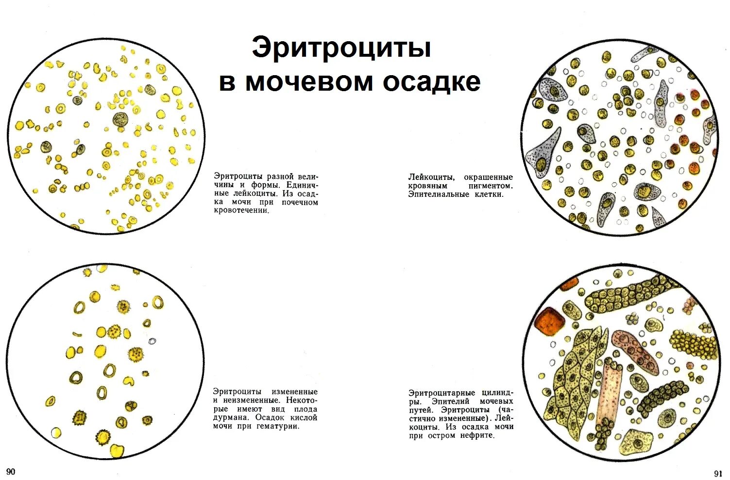 Эритроциты и лейкоциты в моче у мужчин. Микроскопия осадка мочи атлас. Микроскопии осадков мочи Краевский в.я. Краевский атлас микроскопии осадков мочи книга. Атлас микроскопии осадков мочи Краевский в.я.