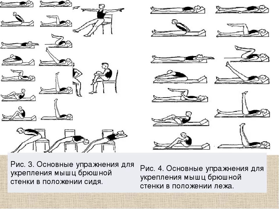 Какие упражнения можно делать после операции. Упражнения для укрепления передней брюшной стенки. упражнения лфк для укрепления передних мышц. упражнения для укрепления мышц брюшной полости. гимнастика на укрепление мышц передней брюшной стенки.