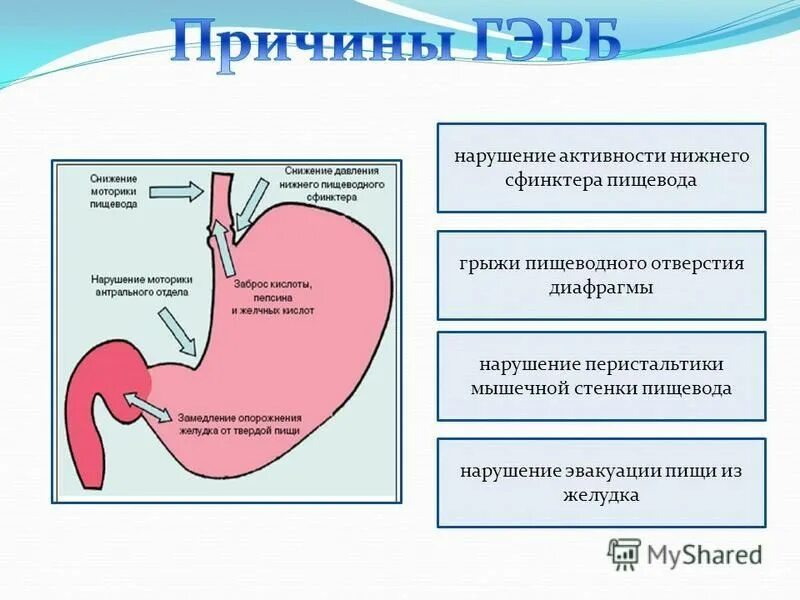 Почему грыжа пищевода. Диета при грыже пищеводного отверстия диафрагмы. Препараты при грыже пищеводного отверстия диафрагмы. ГЭРБ грыжа пищеводного отверстия диафрагмы. Грыжа пищеводного сфинктера.