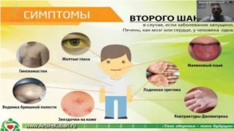 Плохая работа печени. Ожирение печени симптомы. Жировой гепатоз печени лекарства. Лечение жирового гепатоза.