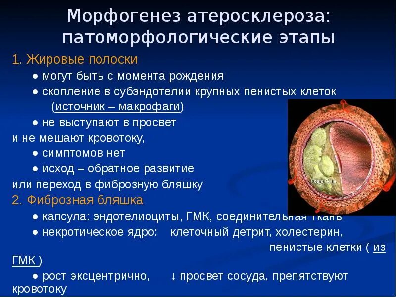 Морфогенез атеросклероза. Стадии морфогенеза атеросклероза. морфогенез атеросклеротической бляшки. патоморфологические стадии атеросклероза.