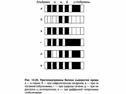 Протеинограмма
