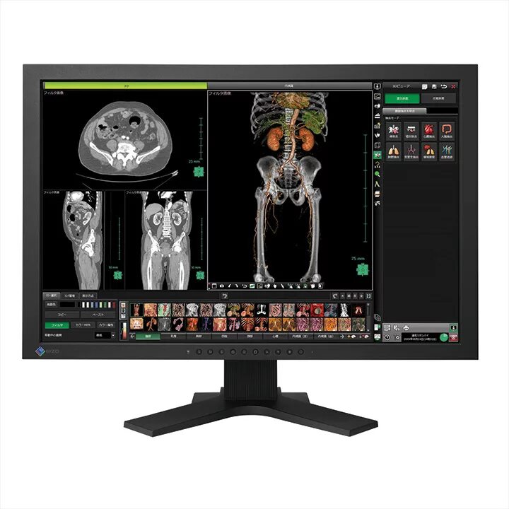 Монитор 10 бит. Монитор eizo radiforce rx430. eizo монитор dicom. монитор eizo radiforce mx242w 32&quot;. монитор eizo radiforce mx194 19&quot;.