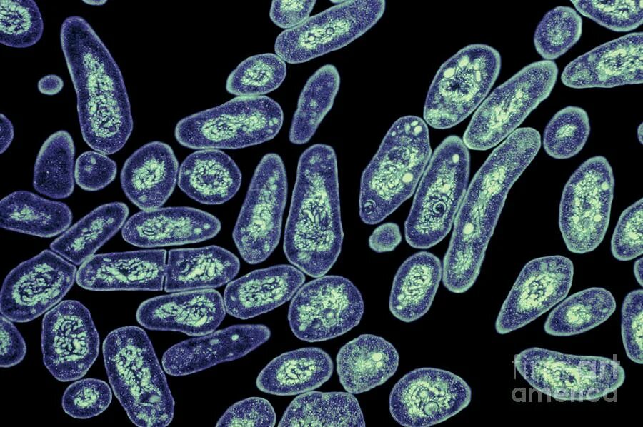 Новый вирус туберкулеза. Бактерия Mycobacterium tuberculosis. Микробактерия туберкулеза микроскопия. Микобактерии туберкулеза под микроскопом. Микобактерии туберкулеза электронная микроскопия.