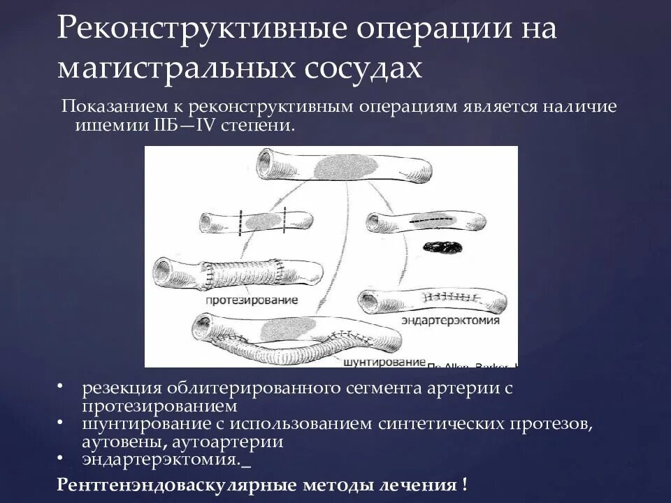 Операция на артерии нижних