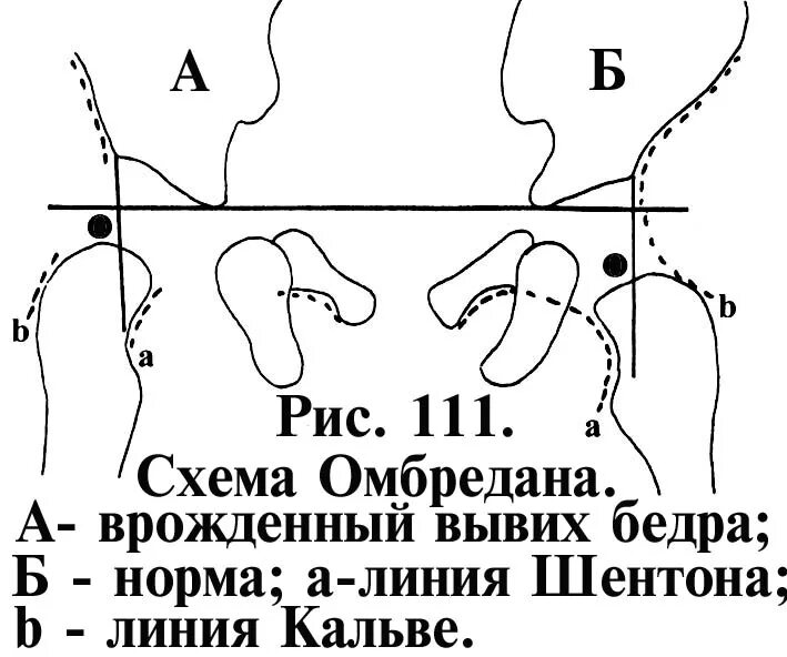 Угол шарпа