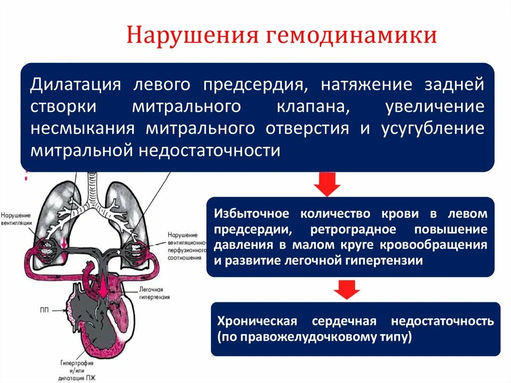 Недостаточность митрального клапана нарушение гемодинамики. Гемодинамика при митральной недостаточности. Нарушение внутрисердечной гемодинамики при пороках. Нарушкниегемолинамики. Митральная недостаточность гемодинамика