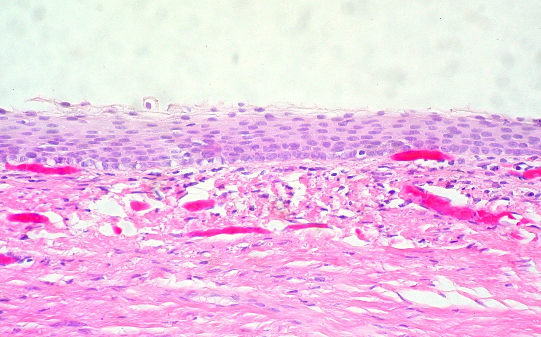 Шейка матки зона трансф. Результат цитологического исследования экзоцервикс эндоцервикс. Эпителия экзоцервикса. Эпителия экзоцервикса. Эпителия экзоцервикса.