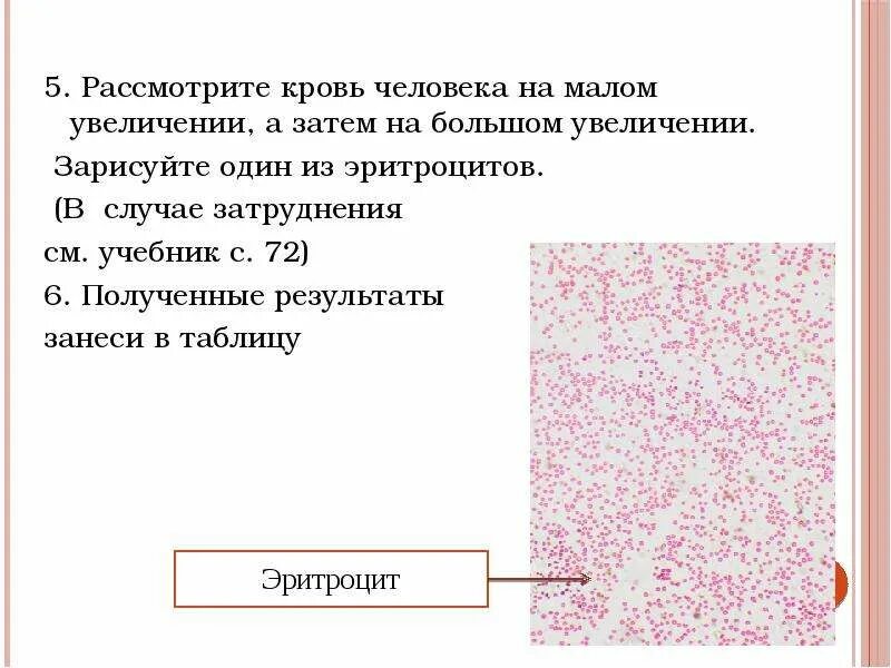 Один из эритроцитов человека. Эритроциты человека при большом увеличении. Кровь человека при большом увеличении. Зарисуйте один из эритроцитов человека. Результаты больше увеличиваются