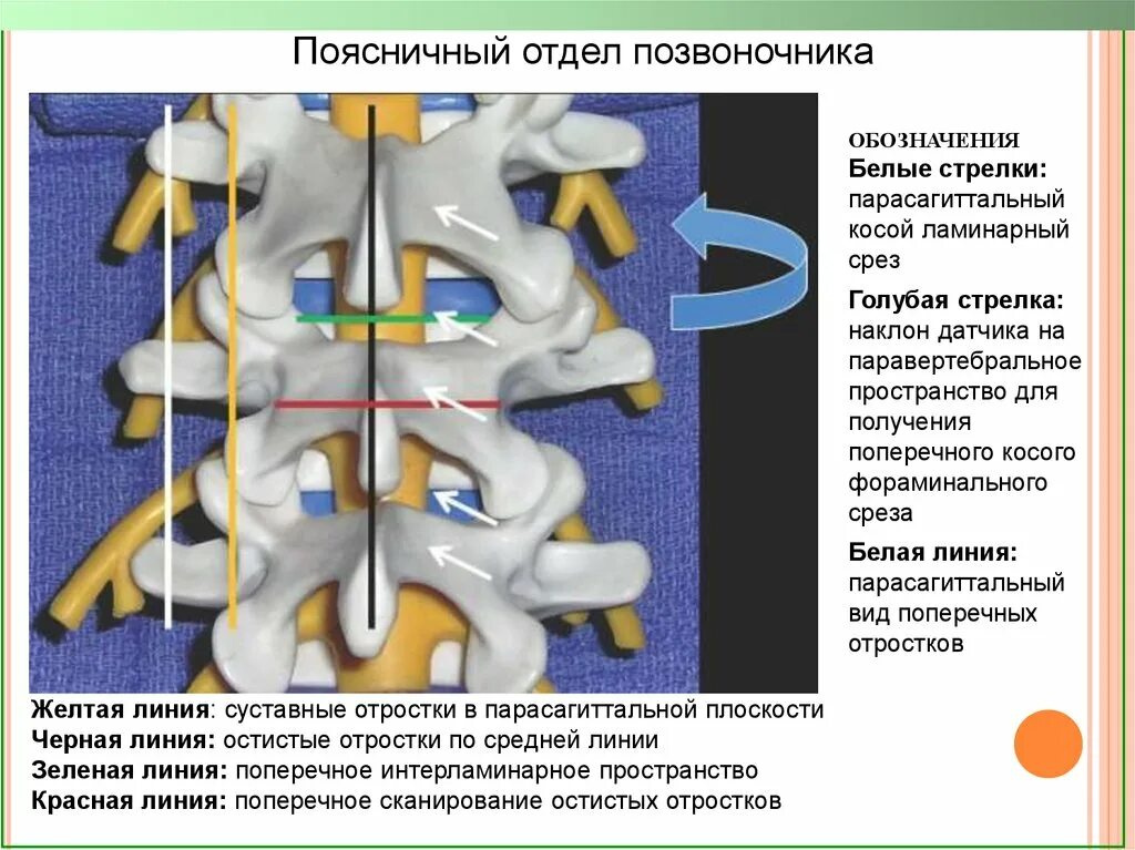 Система в позвоночнике. Паравертебральное пространство. Паравертебрально на поясничный отдел. Тренажер для паравертебральных блокад позвоночника. Паравертебральный отдел позвоночника