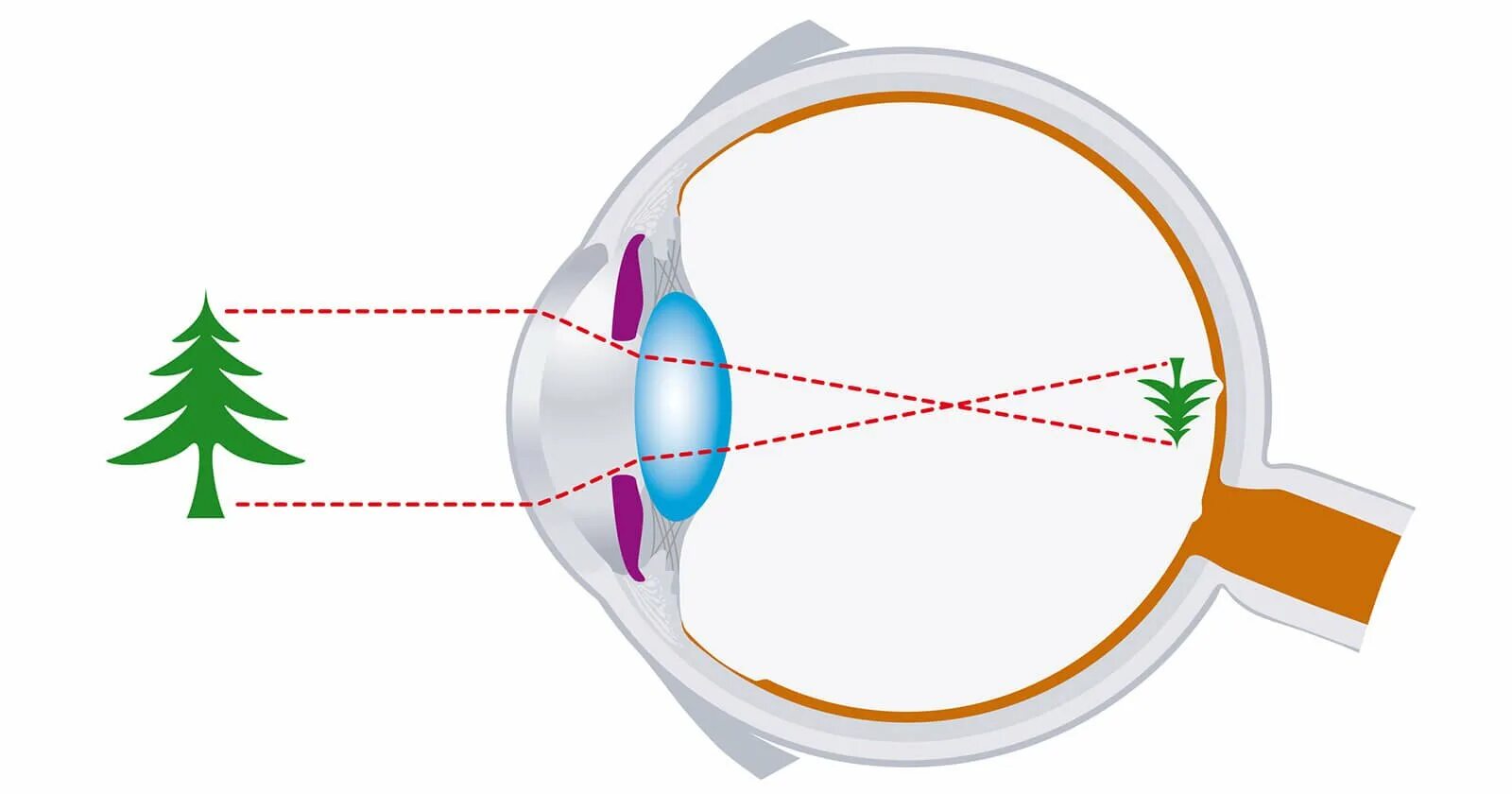Принцип работы зрения. Строение глаза. Строение человеческого глаза. Оптическое устройство глаза. Принцип работы зрения.
