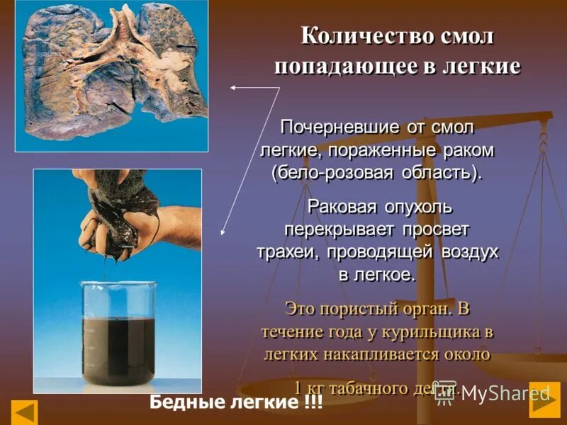 смола в лёгких курильщика. смолы курильщик. легкие курильщика смола. табачная смола. смолы курильщик.