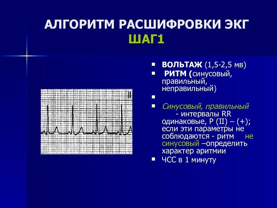 Алгоритм записи экг. Нормальная экг пропедевтика внутренних болезней. общая схема расшифровки экг. экг в норме пропедевтика внутренних болезней. алгоритм расшифровки экг.