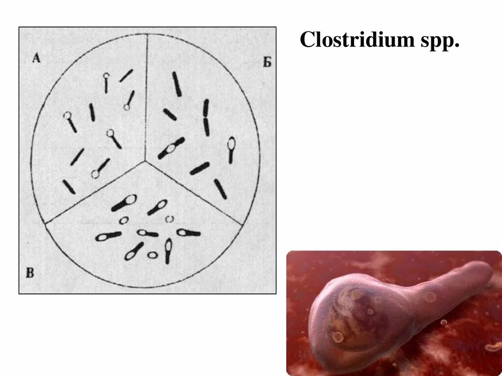 Clostridium spp. Clostridium pasteurianum по Граму. Бактерии рода Clostridium. Клостридии в микроскопе. Клостридии представители.