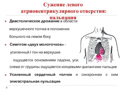 Дрожание грудины