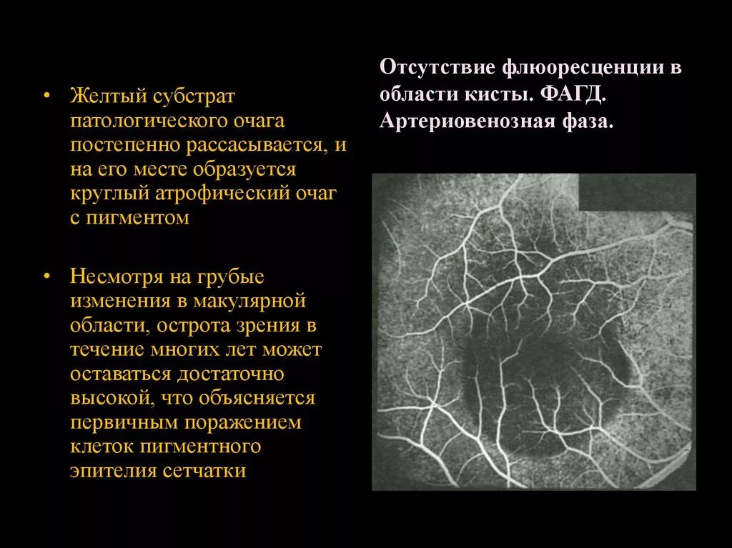 Грубые изменения