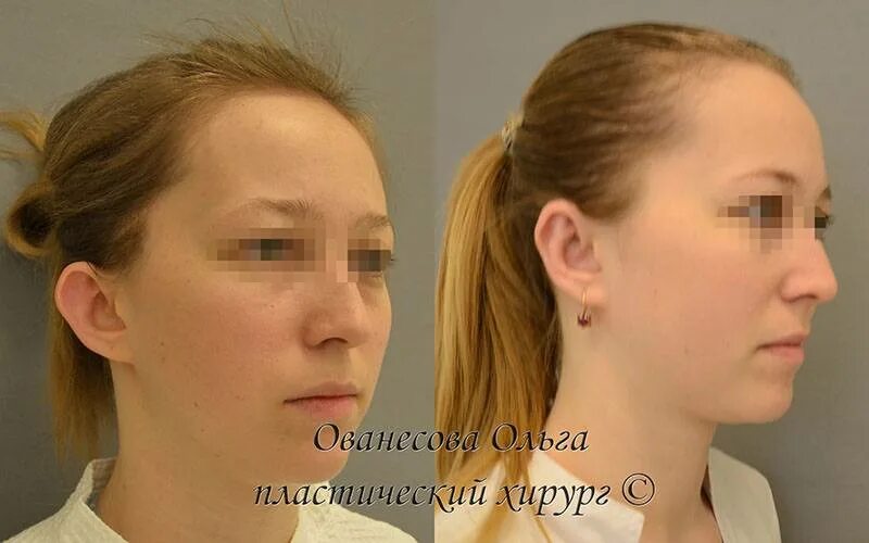 Где делают операцию на уши