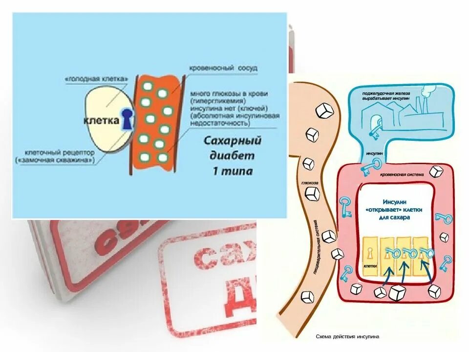 Сахарный диабет 1 типа тесты с ответами. Сахарный диабет i типа. сахарный диабет 1. диабет 1 типа. книга сахарный диабет 1 типа.
