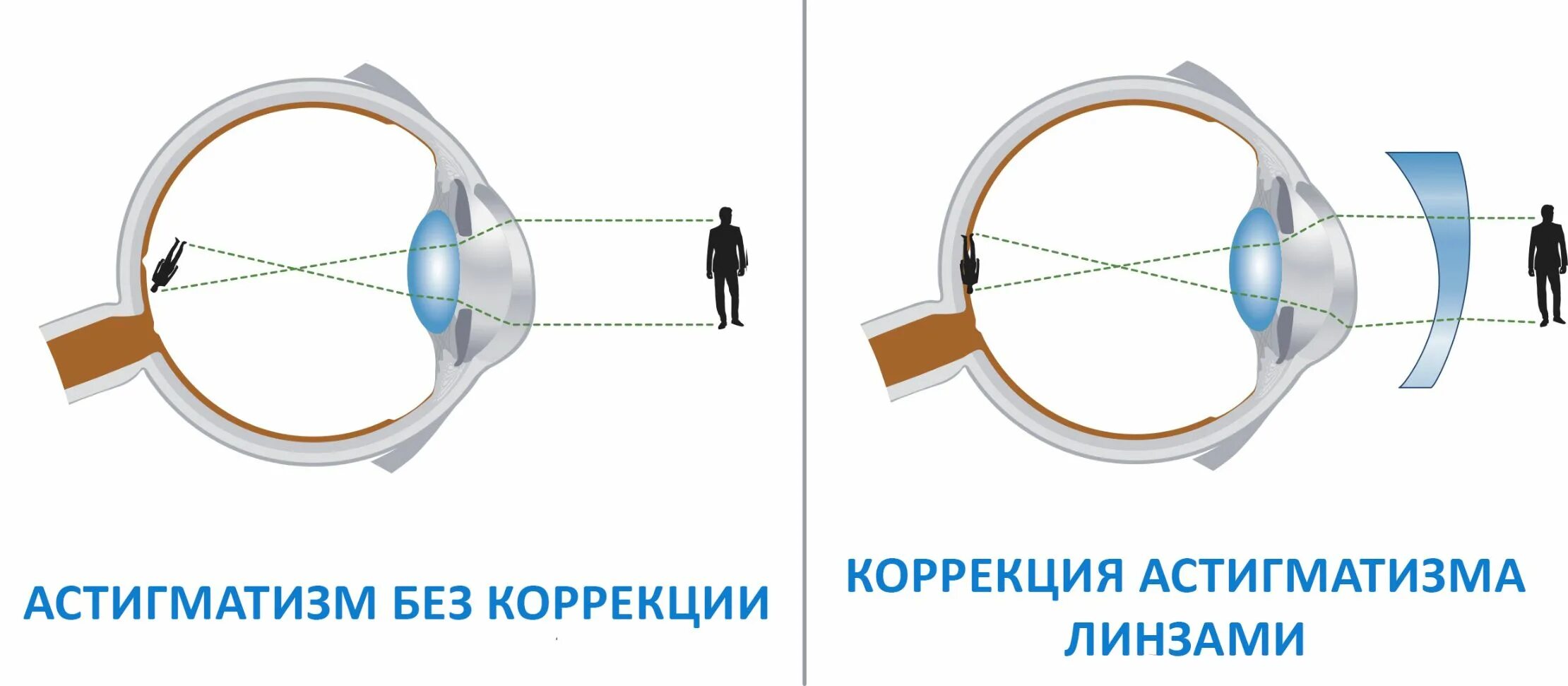 Чем толще линза тем