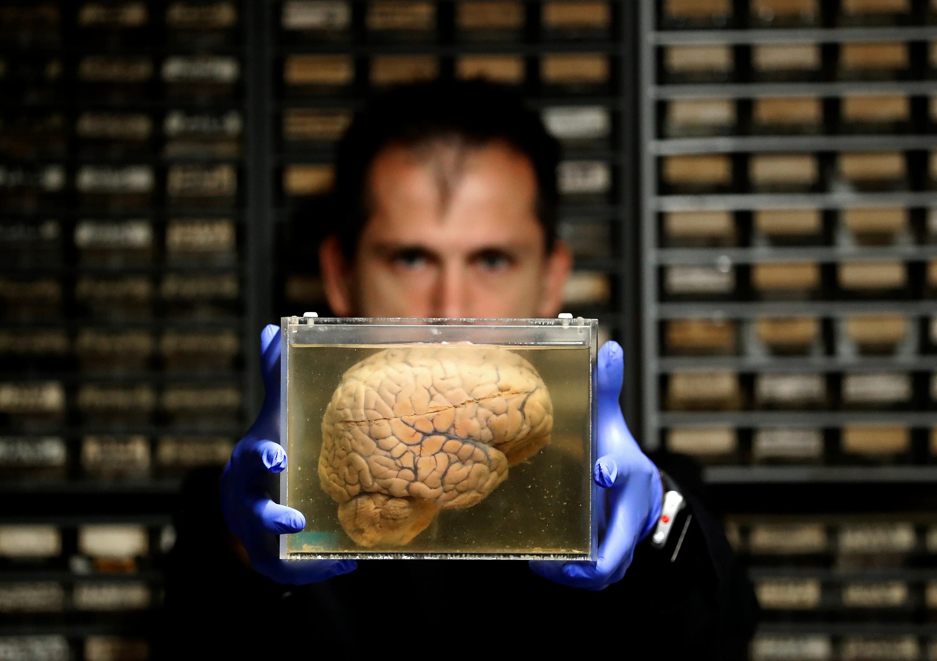 Мозгов тоже. Человеческий мозг живой.