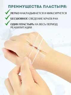 Краев ран