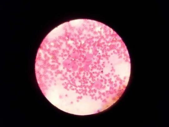 мазок на готовность к вязке у собак. овуляция у собак. овуляция у собаки прогестерон. тест на овуляцию микроскоп. овуляция.