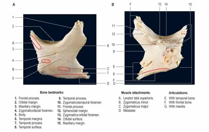 Анатомия скуловой кости. Скуловая кость черепа анатомия. Скуловая кость вид изнутри. Facies lateralis скуловой кости. Скуловая кость, анатомические структуры..