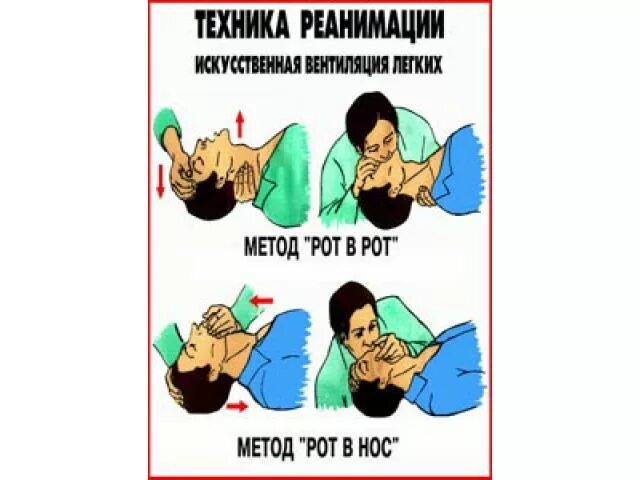 искусственная вентиляция легких алгоритм