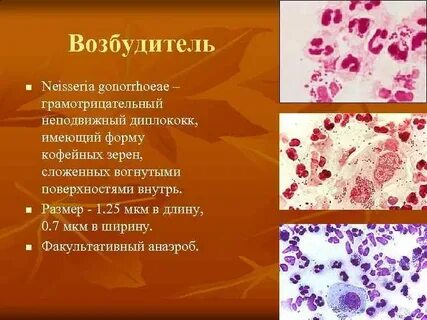 Гонорея возбудитель