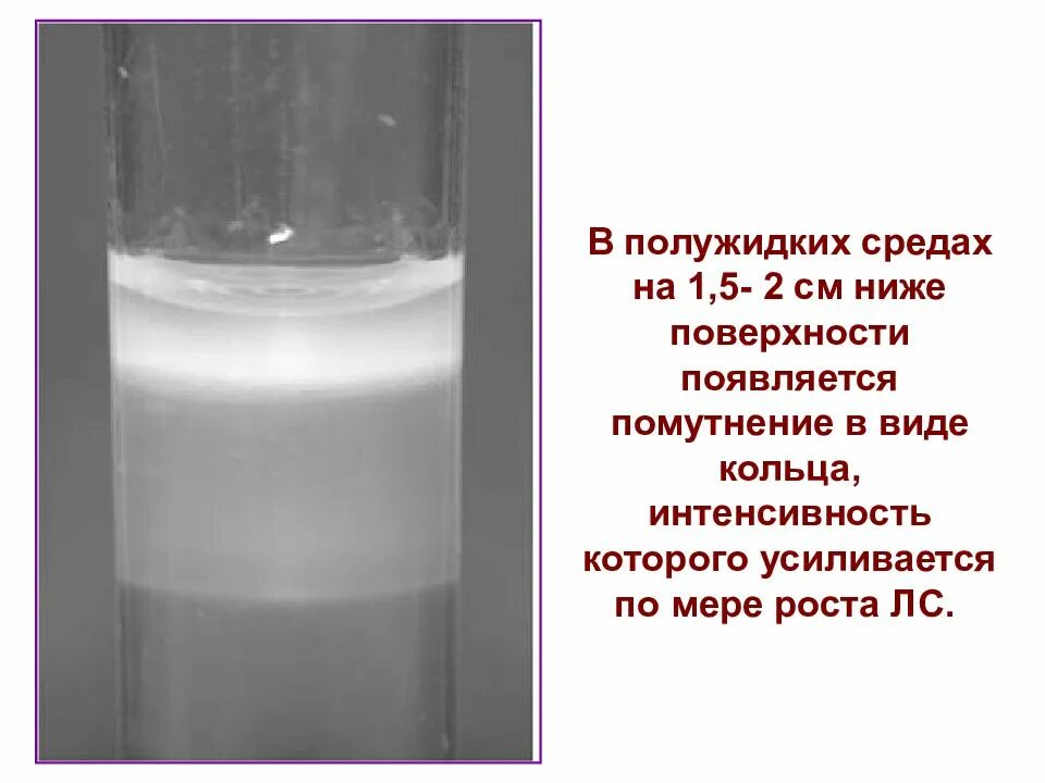 Какой газ вызывает помутнение известковой. Неподвижность на полужидких средах. Лабораторное исследование на лептоспироз. Диагностика в полужидкой среде. Микоплазма на полужидкой среде.