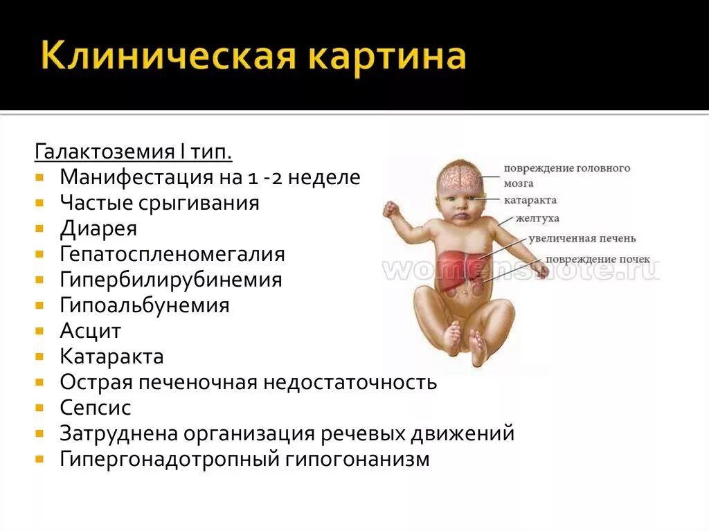 Типа у ребенка форум